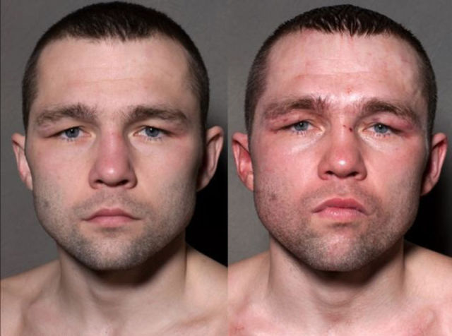 A Boxer s Face Before And After Taking A Few Punches 11 Pics 