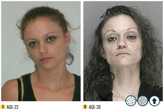 The Shocking Effects of Meth Addiction: Before and After