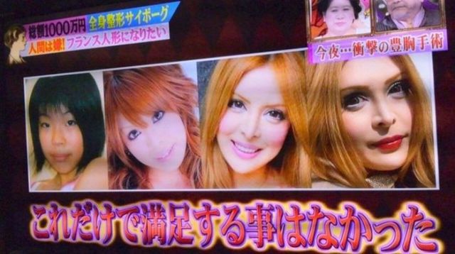 Plastic Surgery Transforms Japanese Model into a Living French Doll