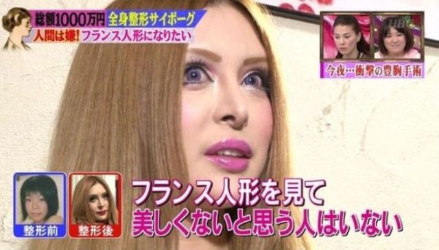 Plastic Surgery Transforms Japanese Model into a Living French Doll