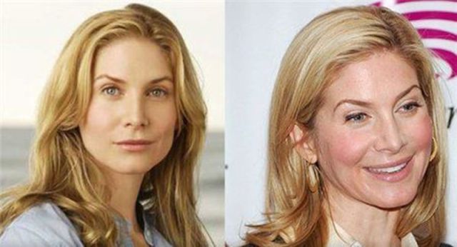 The ‘Lost’ Cast Before and After the Series