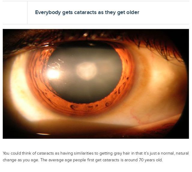 Things That You Didn’t Know about Your Eyes