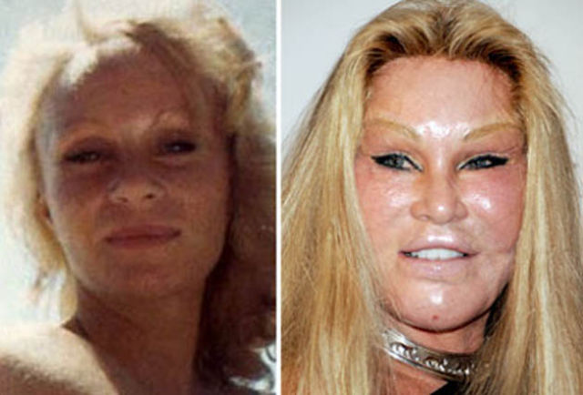 If You’re Thinking about Having Plastic Surgery. Think Again!