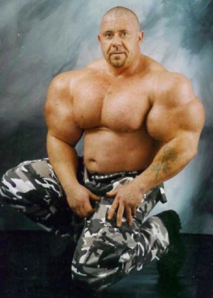 Injecting Synthol Into Your Muscles Can Make You Instantly Look Like a Douchebag