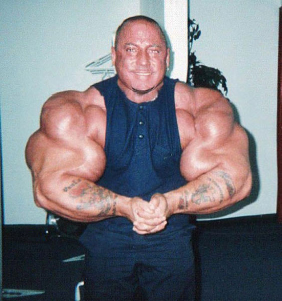 injecting_synthol_into_your_muscles_can_make_you_instantly_look_like_a_douchebag_640_20.jpg