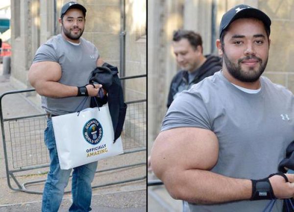 Injecting Synthol Into Your Muscles Can Make You Instantly Look Like a Douchebag