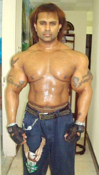 Another Person Becomes a Victim of Synthol