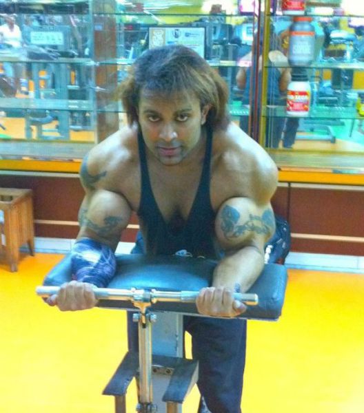 Another Person Becomes A Victim Of Synthol 17 Pics