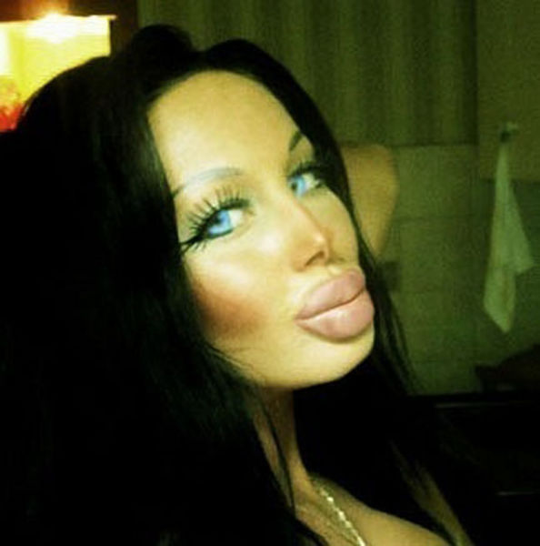 Another Example of Plastic Surgery Overkill