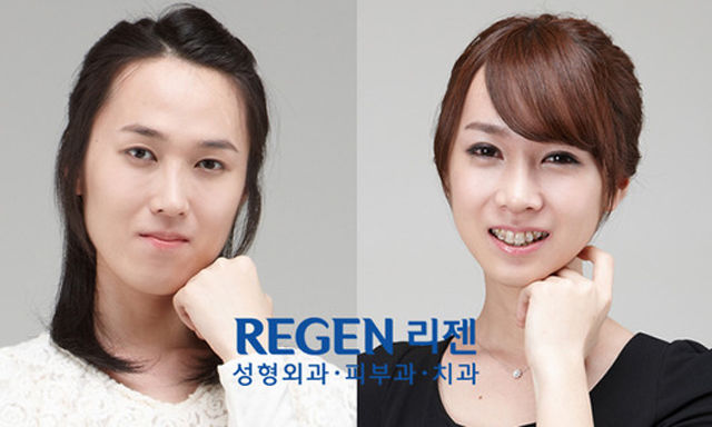 Before and After Photos of Korean Plastic Surgery. Part 2