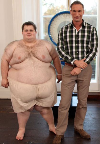 The ‘Human-Doughnut’ Loses Serious Weight