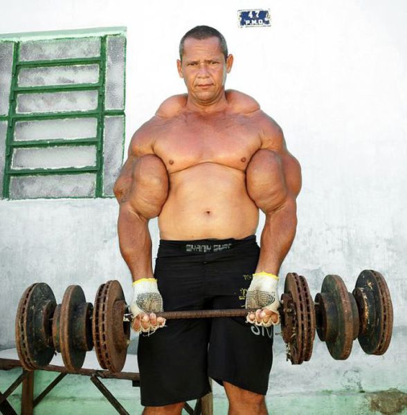 The Man Whose Monster Arms Might Actually Kill Him