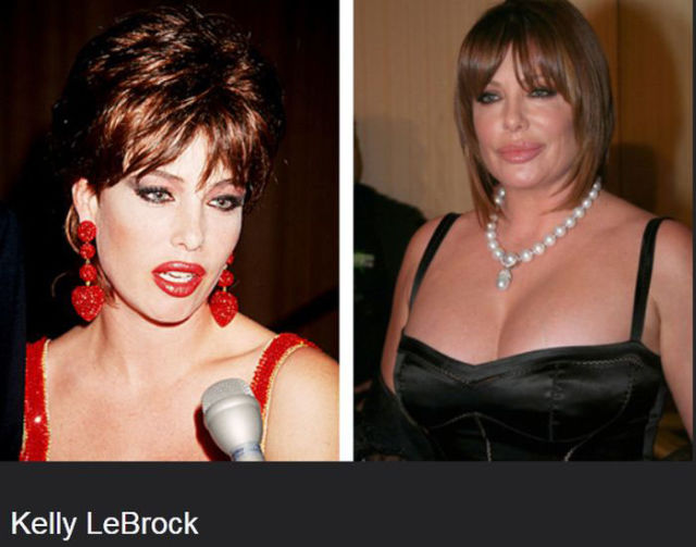 Celebs Who Are Not Aging Very Well At All