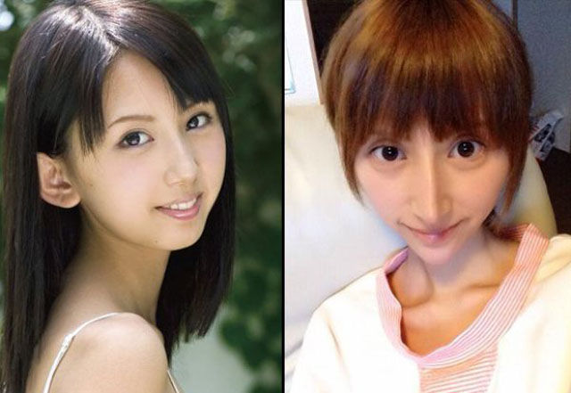 Japanese Porn Star Pre And Post Plastic Surgery 14 Pics