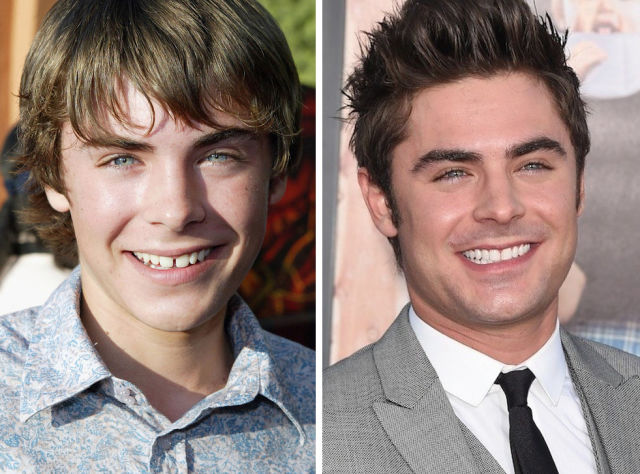 Proof That Teeth Can Completely Change the Way You Look