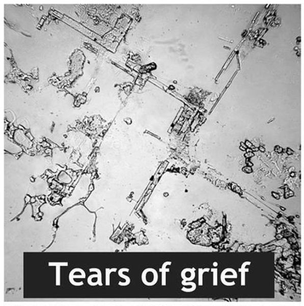 Fascinating Images of Dried Human Tears