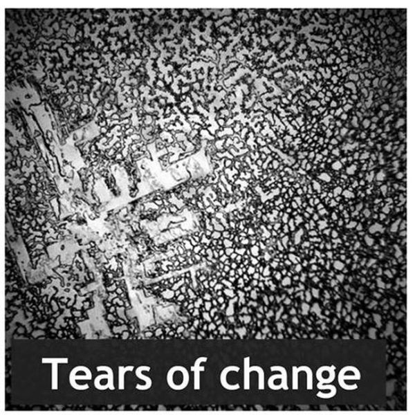 Fascinating Images of Dried Human Tears