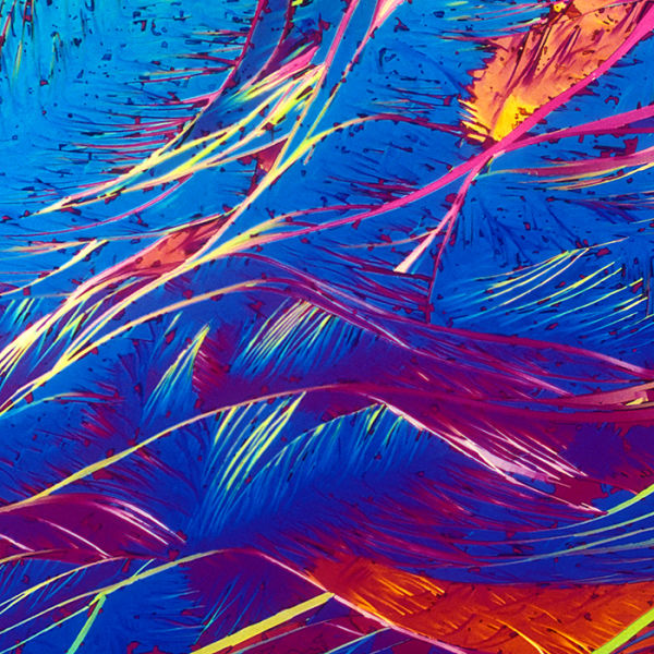 A Few Popular Alcoholic Drinks Under a Microscope
