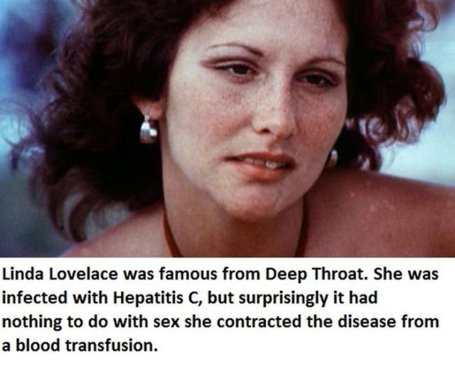 Celebs Who Really Have STDs