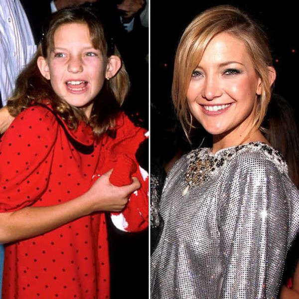 A Nostalgic Look at Photos of Young Movie Stars