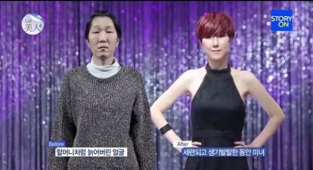 Korean Woman Gets a Whole New Face Shape