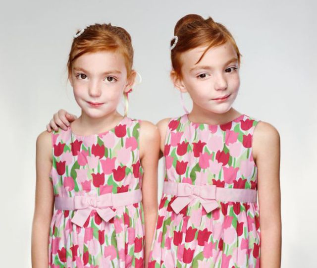 Identical Twins with Nearly Unnoticeable Minor Differences