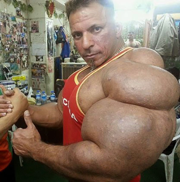 This Guy Has the Most Gigantic Arm Muscles Ever