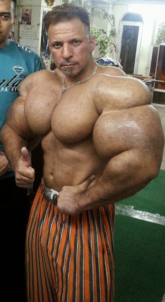 This Guy Has the Most Gigantic Arm Muscles Ever