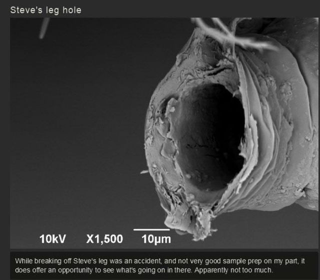 One Dude’s Gruesome Discovery of What Was Lurking on His Foot