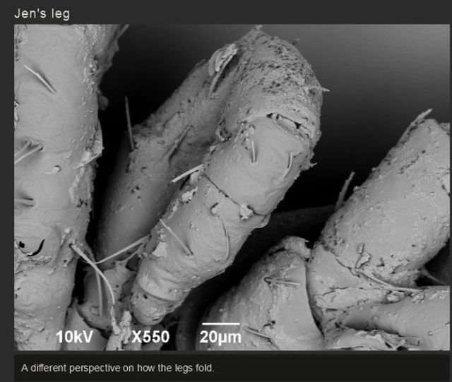 One Dude’s Gruesome Discovery of What Was Lurking on His Foot