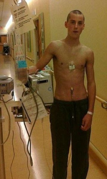 Lymphoma Patient Transforms His Body into a Fitness Machine