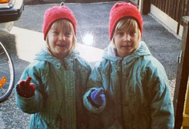 The Twins Who Have Had Identical Plastic Surgery 23 Pics