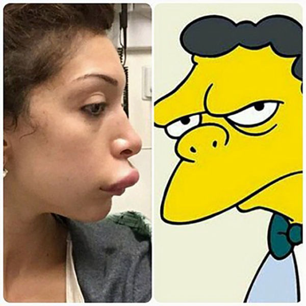 Teen Mom’s Dramatic Lip Enhancement Fail (11 pics)