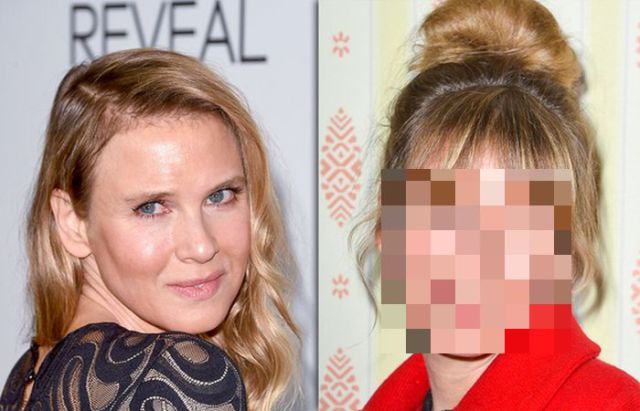 Renee Zellweger’s Face Seems to Be Back to Normal
