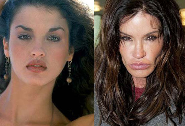 Celebrity Surgeries That Didn’t End Well