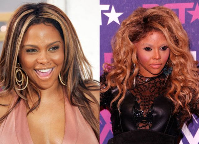 Celebrity Surgeries That Didn’t End Well