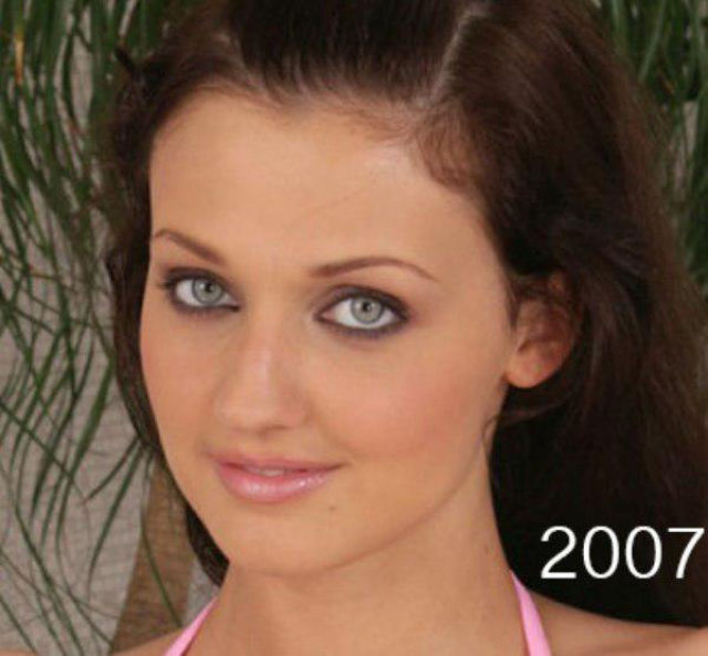 A Porn Star’s Dramatic Plastic Surgery Makeover