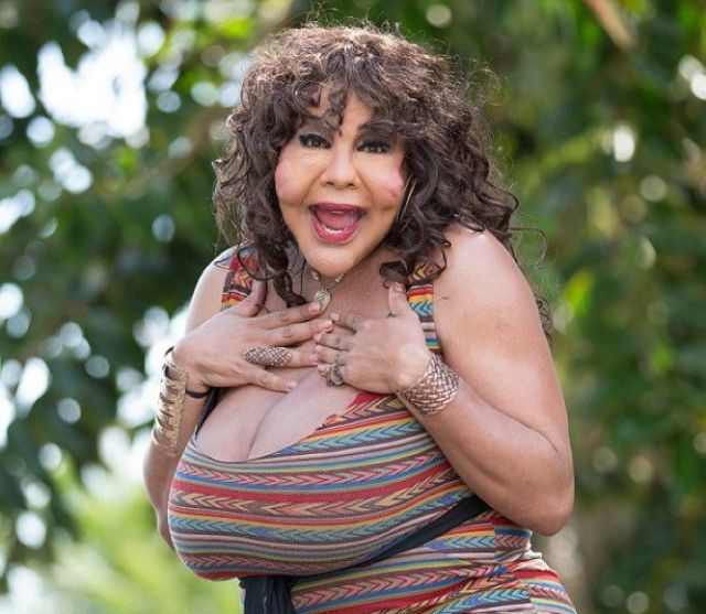 Disfigured Transgender Woman Shows off Her New Face