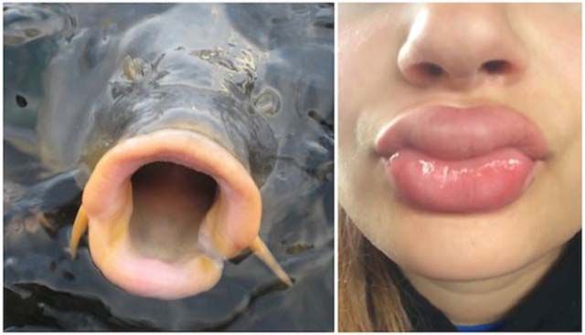 Kylie Jenners Lip Challenge Is Giving Girls Fish Lips 14 Pics