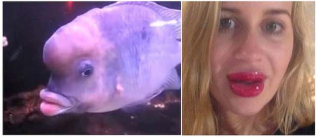 Kylie Jenner’s Lip Challenge Is Giving Girls “Fish Lips”