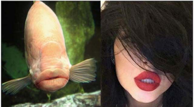 Kylie Jenner’s Lip Challenge Is Giving Girls “Fish Lips