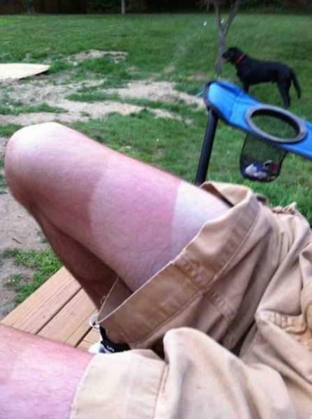 Sunscreen Is an Essential Summer Item