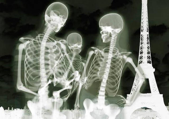 X-Rays Show the Human Body Like You’ve Never Seen It Before