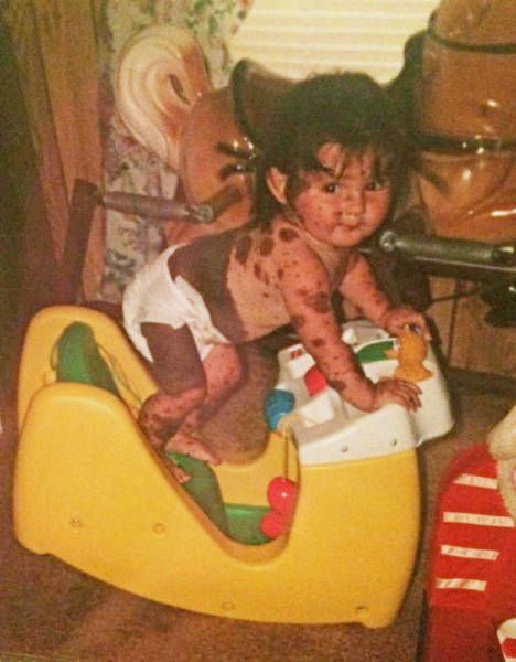 This Inspiring Teen Is Not Letting Her Birth Defect Stand in Her Way