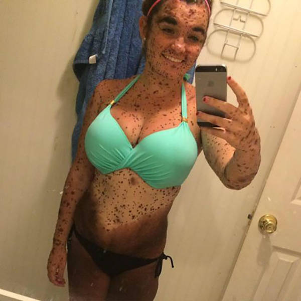 This Inspiring Teen Is Not Letting Her Birth Defect Stand in Her Way