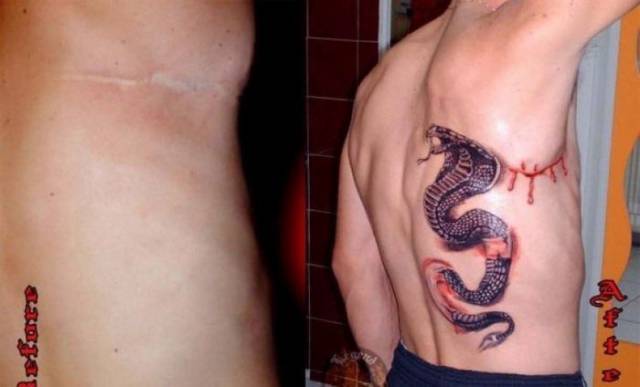 Clever Tattoos Provide Some Beautiful Camouflage for Bad Scars