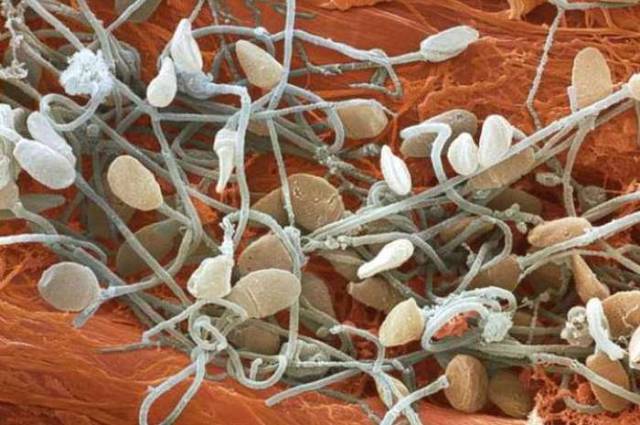 The Human Body Under a Microscope (18 pics) - Izismile.com