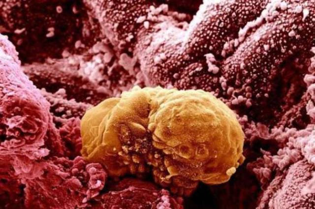 The Human Body Under a Microscope