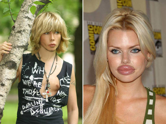 Plastic Surgery Fails That Will Make You Love Your Natural Looks