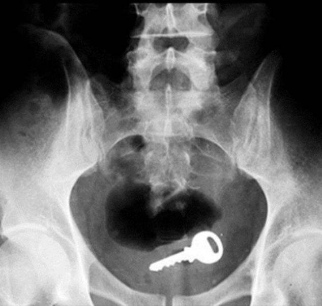 X-Rays of Objects Stuck in Really Strange Places